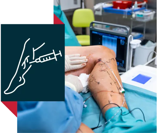 Varicose Vein Treatment