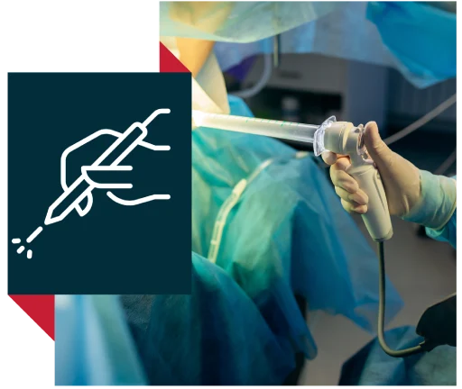 Laser Proctology