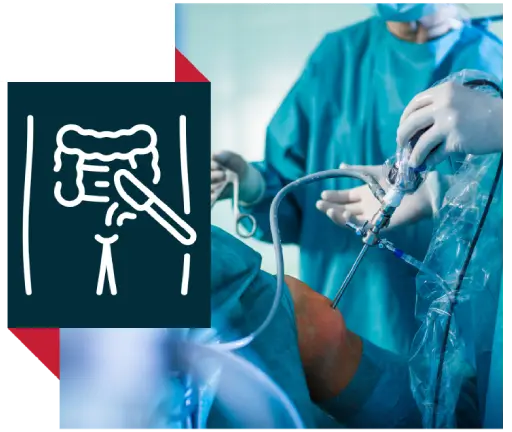 Gastrointestinal Surgery