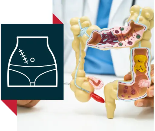 Appendix & Emergency Surgery