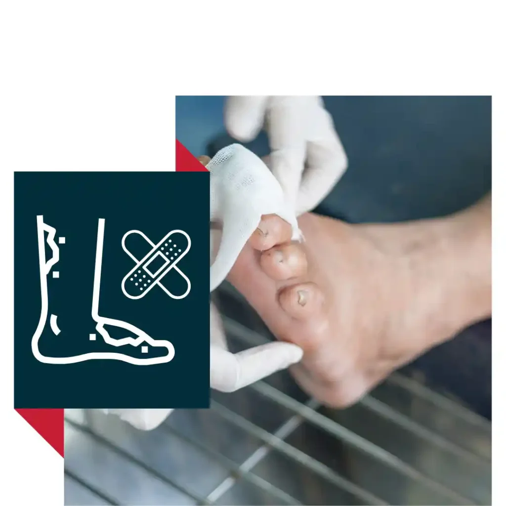 Diabetic & Wound Management