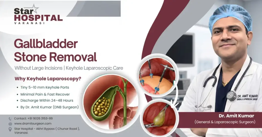Best Doctor for Gallbladder Stone in Varanasi | Laparoscopic Surgery & Cost